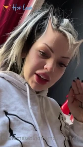 5886876
