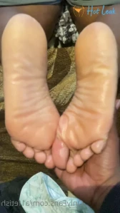 7772372