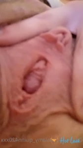 7767352