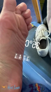 7767171