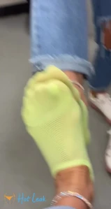 7767176