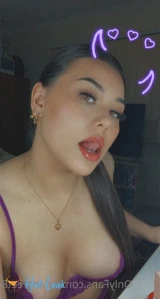 7572665
