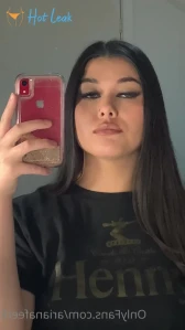 7763794