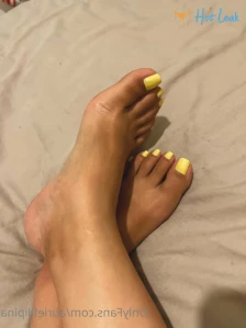 7566765