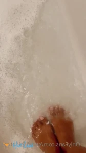 7762655