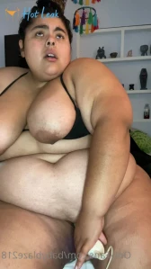 7761693