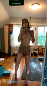 7761581