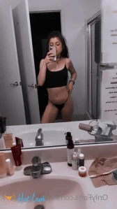 7761584
