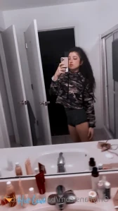7761587