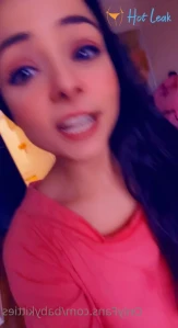 7761538