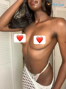 7626415
