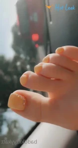 7761137