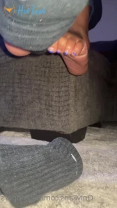 7756082
