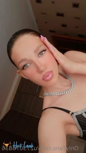 7620002