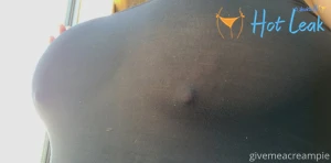 11795154
