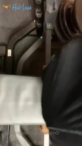 7751624