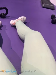 7611473