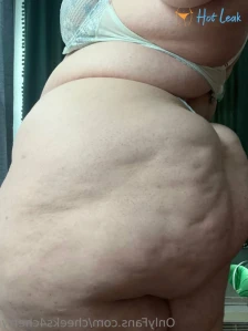11309569
