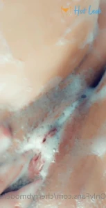 7744354