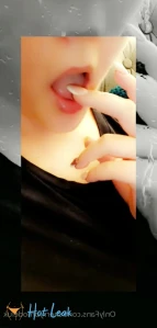 7744384