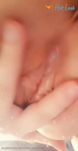 7744427