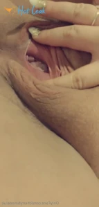 7744443