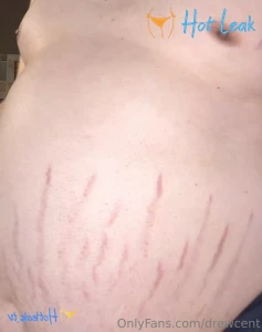 11705659