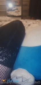 7666139