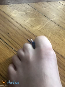 7453379