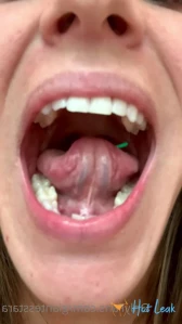 7593454
