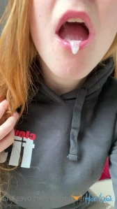 7592356