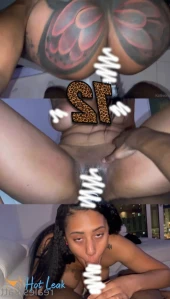 11302314