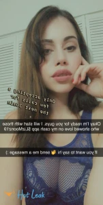 7329615