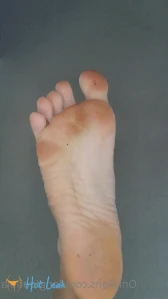 7264009