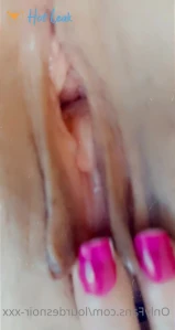 7261130