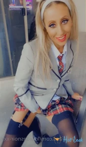 7261172