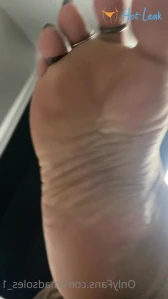 7229844