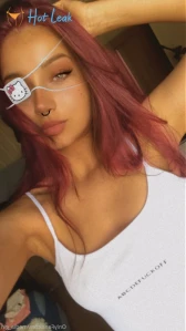 7232415