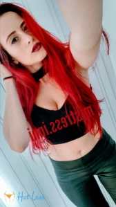 7259177