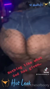 11631176