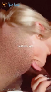 7255867