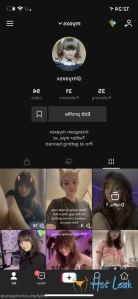 7255902