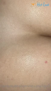 7134452