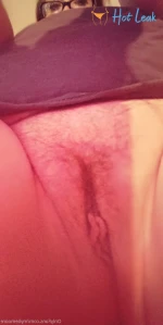 7244927