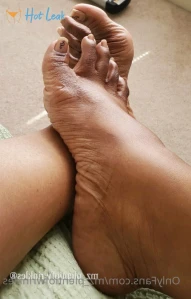 6728866