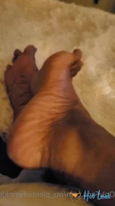 7119293