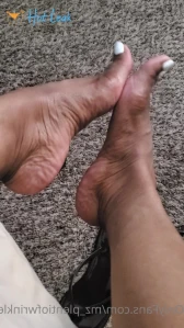 7119389