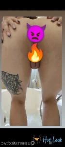 10424318