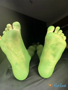 7146483