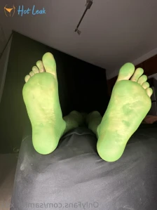 7146557